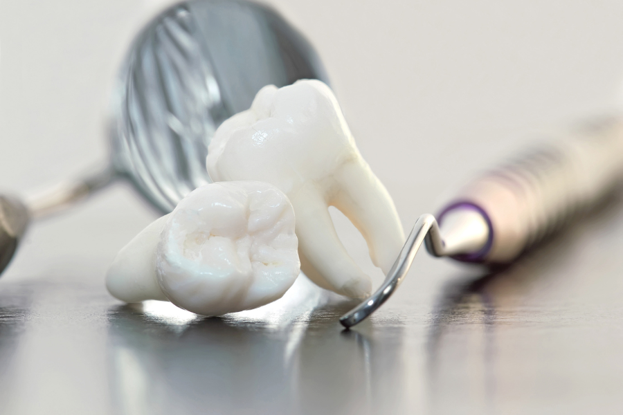 Wisdom Teeth Removal in Chandigarh | Dantaa Dental Clinic